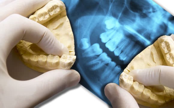 Osteopatia odontoiatrica