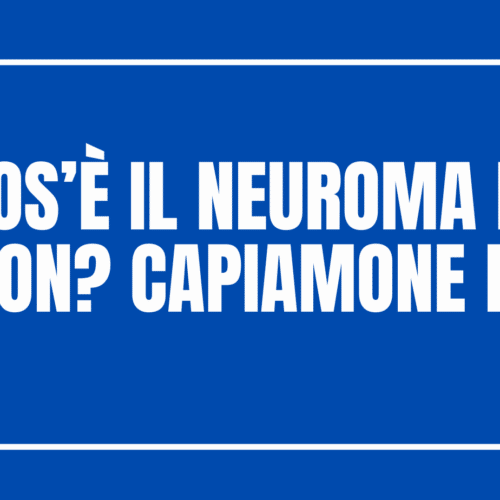 Cos’è il Neuroma di Morton Capiamone di più!