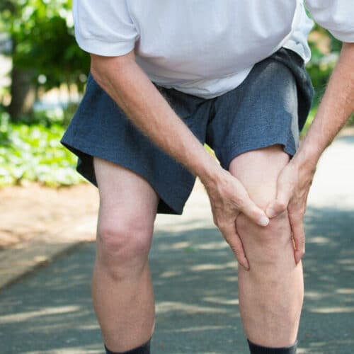 ARTROSI: come capisco se ho l’artrosi alle ginocchia?