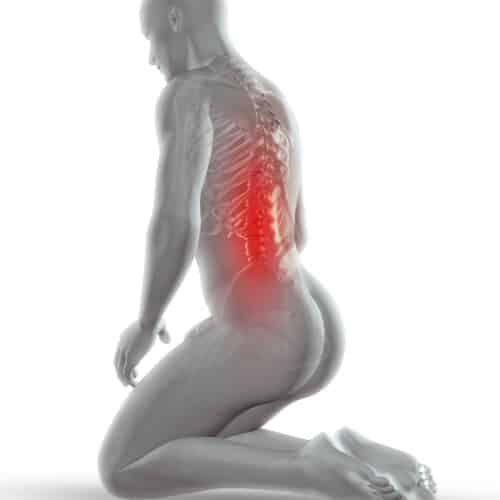 come far passare il mal di schiena