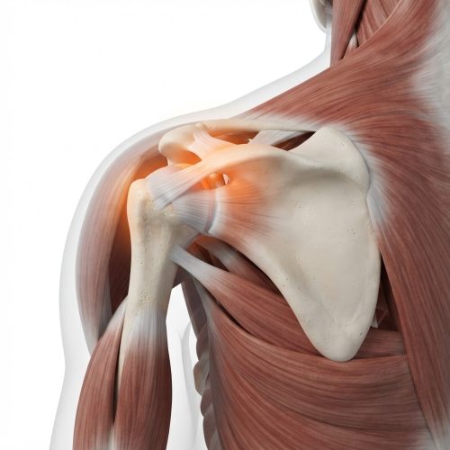 Dolore alla spalla di notte: anatomia della cuffia dei rotatori e tensione della spalla